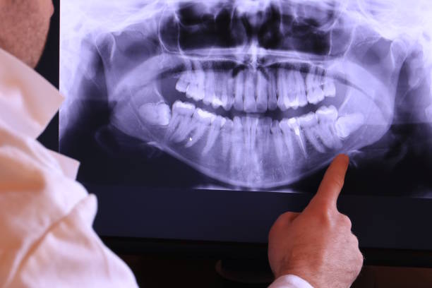 Best Emergency Dental Care for Sports Injuries in Masonville, KY