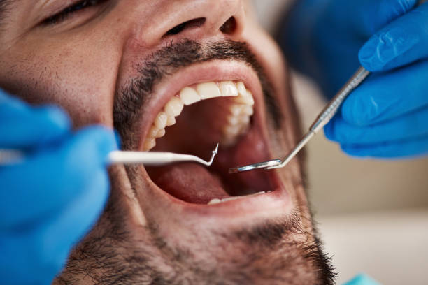 Best Emergency Denture Repair in Masonville, KY